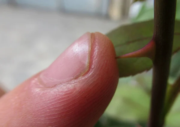 Cerca Macho Hombre Dedo Tocando Planta Flor Cuerno Rosa —  Fotos de Stock