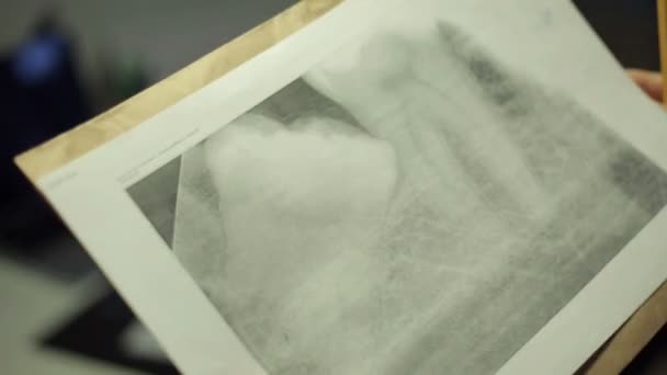 Doctor looking at x-ray of jaw — Stock Video