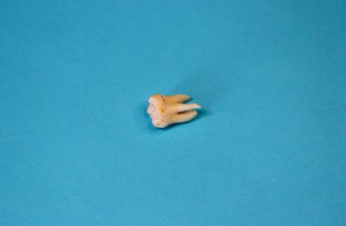 Mavi arka planda çıkarılmış yirmilik dişi, yakın plan.