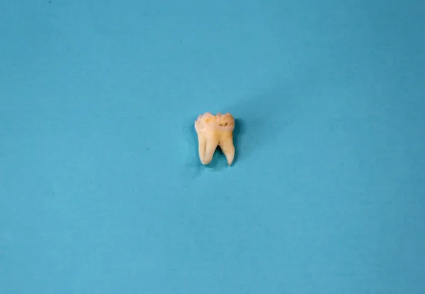 Wyciągnięty Ząb Mądrości Niebieskim Tle Zbliżenie — Zdjęcie stockowe
