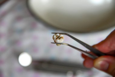 Diş aletlerinin arka planına karşı cımbızla çekilen diş.