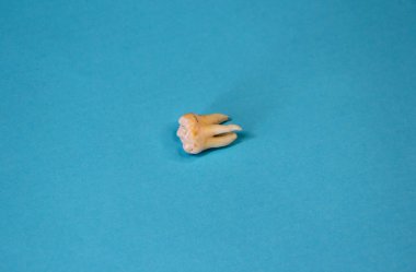 Mavi arka planda çıkarılmış yirmilik dişi, yakın plan.