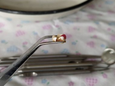 Çok renkli diş dolgusu olan testereli bebek dişi. Cımbızı kapat.