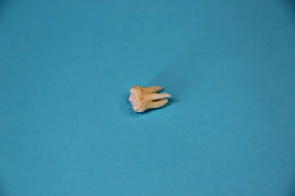 Extracted wisdom tooth on the blue background, close-up
