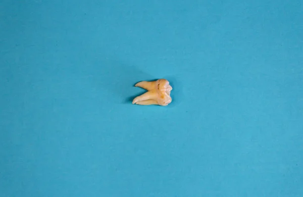 Extracted wisdom tooth on the blue background, close up