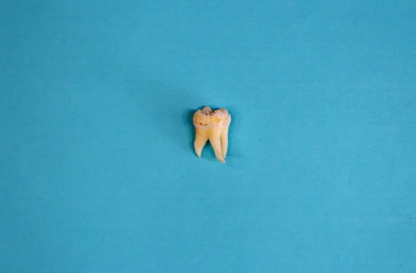 Extracted wisdom tooth on the blue background, top view