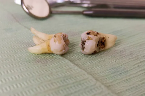 Dental instruments and extracted teeth on the napkin