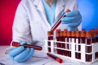 Araştırma laboratuarında kan tüpü testi yapan bir teknisyen. Coronavirus testi. Doktor laboratuardaki askıdan kan örneği alıyor.