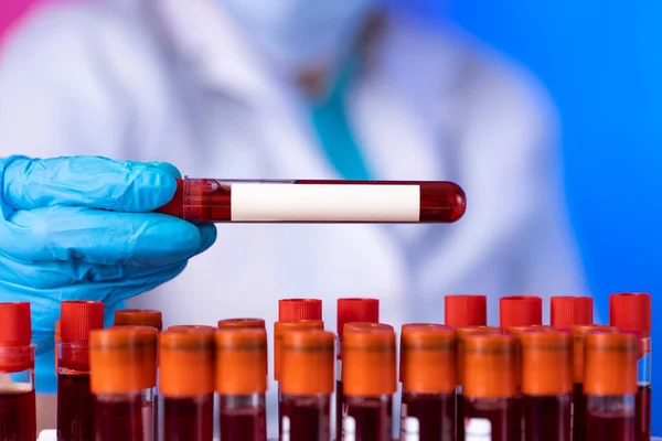 Technician Holding Blood Tube Test Research Laboratory Coronavirus Testing Doctor — Stock Photo, Image