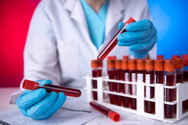 Tekniker Som Håller Blodrörstest Forskningslaboratoriet Coronavirus Test Läkaren Tar Ett — Stockfoto