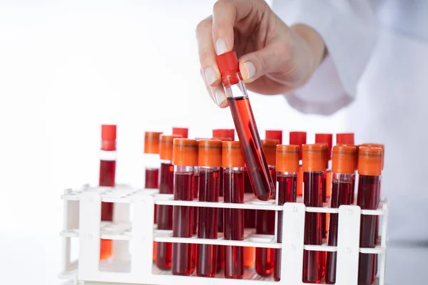 Doktor Laboratuardaki Askıdan Kan Örneği Tüpü Alıyor — Stok fotoğraf