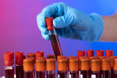 Doktor el, laboratuardaki askıdan kan örneği tüpü alıyor.