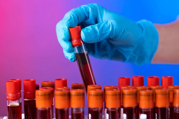 Doctor Hand Taking Blood Sample Tube Rack Lab — Stock Photo, Image