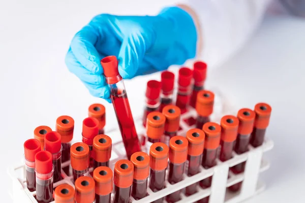 Läkarens Hand Tar Ett Blodprovsrör Från Ett Rack Labbet — Stockfoto