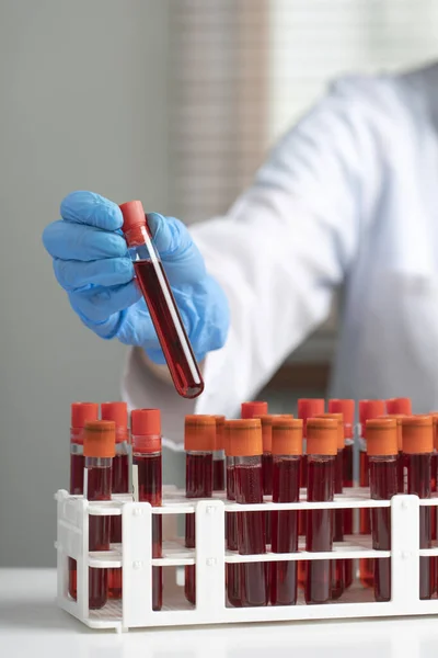 Doctor Hand Taking Blood Sample Tube Rack Lab — Stock Photo, Image