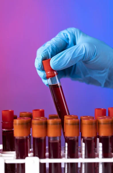 Ärztin Entnimmt Labor Eine Blutprobe Aus Einem Regal — Stockfoto