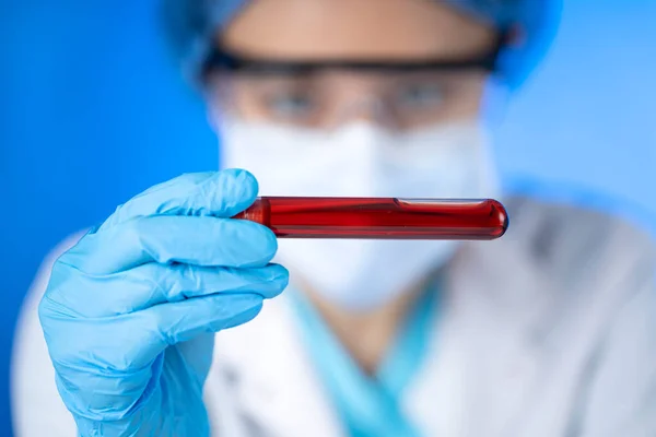 Tekniker Som Håller Blodrörstest Forskningslaboratoriet Coronavirus Test Kvinna Läkare Tittar — Stockfoto