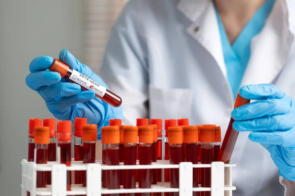 Doctor Hand Taking Blood Sample Tube Rack Lab Coronavirus Test — Stock Photo, Image