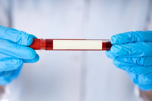 Technician Holding Blood Tube Test Research Laboratory Coronavirus Testing — Stock Photo, Image