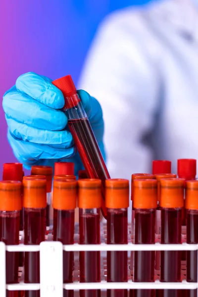 Läkarens Hand Tar Ett Blodprovsrör Från Ett Rack Labbet — Stockfoto