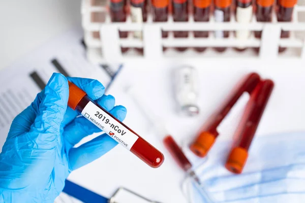 Techniker Mit Blutröhrchen Test Forschungslabor Coronavirus Tests Arzt Entnimmt Blutprobenröhrchen — Stockfoto