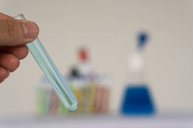 Deney tüpü tutan profesyonel bir bilim adamı ya da araştırmacı pipetin numunesini test tüpünün içine indirir. Virüs analizi ile Corona COVID-19 yakın dönem bilimsel laboratuvar testinde