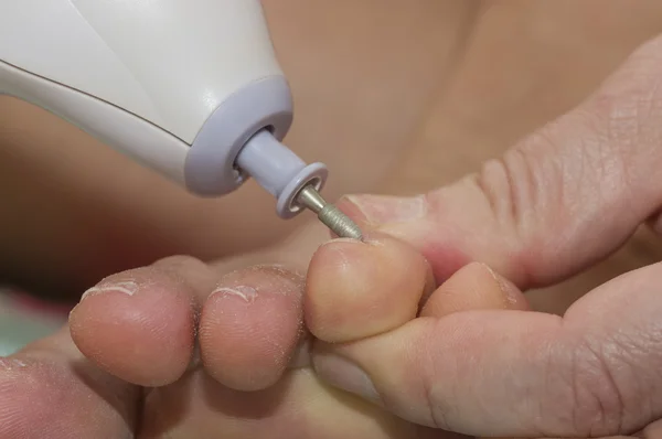 Tratamiento de uñas en sus pies — Foto de Stock