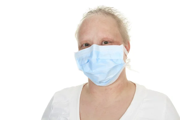 Een chemotherapie vrouw dragen van een medische masker. — Stockfoto