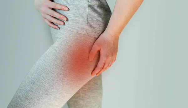 신체 신경 자극으로 인한 엉덩이 근육의 통증인 피리 포름 증후군을 앓고 있는 여성 — 스톡 사진