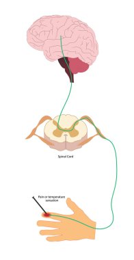 Pain Pathway. Nociception. Ascending pathway that connect the periphery with the brain during pain and temperature sensation. Hand, spinal cord and brain. clipart