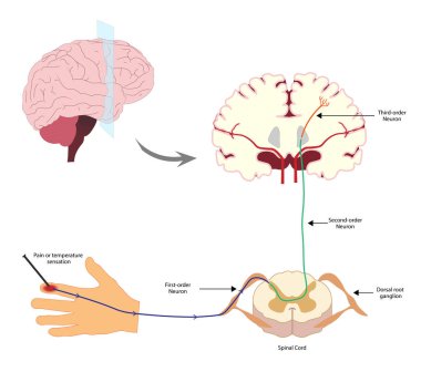 Pain Pathway. Nociception. Ascending pathway that connect the periphery with the brain during pain and temperature sensation. Hand, spinal cord and brain. clipart