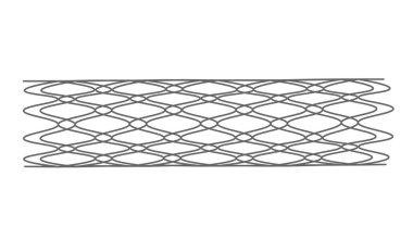 Endovascular metal Stent illustration. Expanded stent clipart