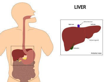 Kolostomi - Kolostomi torbasının konumu