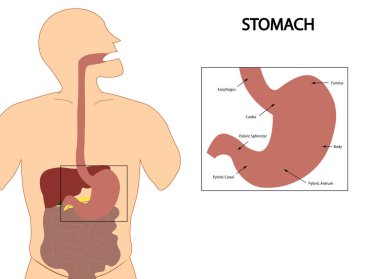 Kolostomi - Kolostomi torbasının konumu
