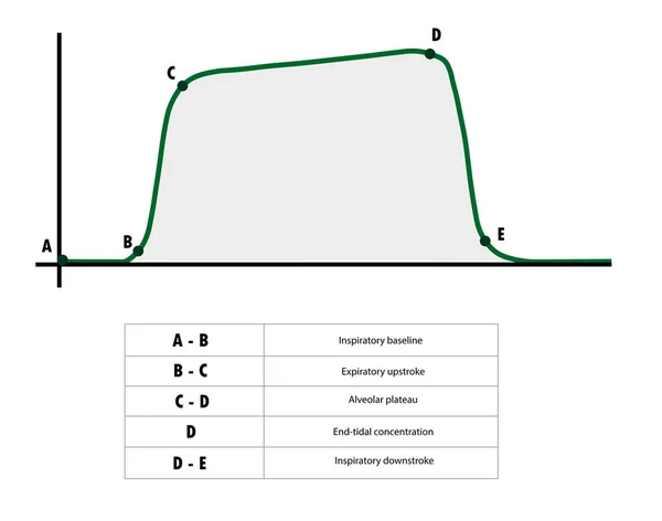 Capnografi Dalga Biçimi Aşamaları. Capnografi dalga formundan her aşamanın tanımı. Normal Eğri