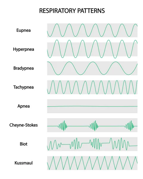 Solunum yolu desenleri. Farklı durumların solunum eğrileri. Eupnea, hiperpne, bradipne, taşipne, Apnea, Cheyne-Strokes, Biot, Kussmaul.