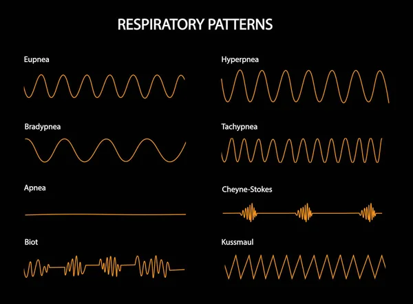 Patrones Respiratoy Curvas Respiratorias Diferentes Situaciones Eupnea Hiperpnea Bradipnea Taquipnea —  Fotos de Stock