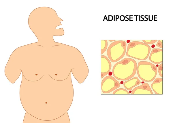 Células Tejido Adiposo Ilustración Obesidad Con Células Tejido Adiposo — Foto de Stock