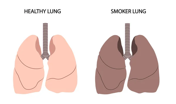 Ilustración Pulmonar Saludable Fumador — Foto de Stock