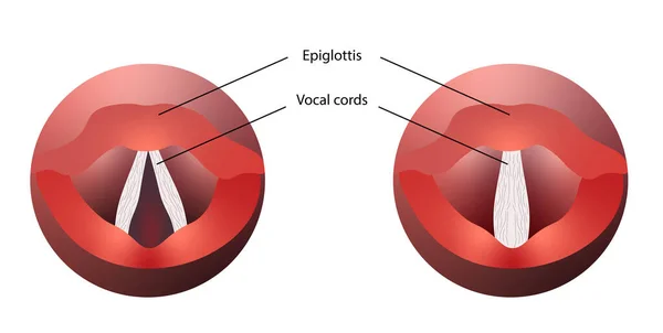 Diyagram açık ve kapalı ses telleri anatomisini gösteriyor