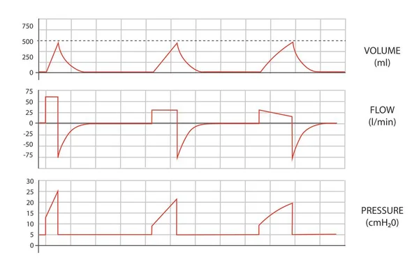 Mekanik havalandırma dalgaları. Mekanik vantilatörden ses, akış ve basınç eğrileri.