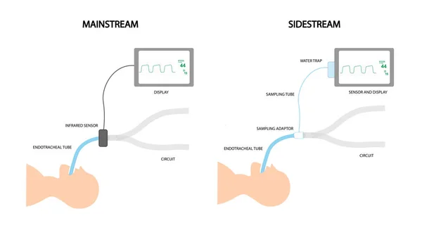 Kapnográfia Különbség Mainstream Sidestream Technológiák Között — Stock Fotó