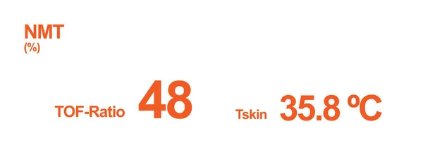 Nöromüsküler iletim (NMT) monitör ekranı. Hastanede NMT izleniyor.