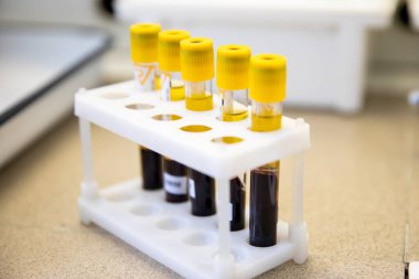 Laboratuvardaki test tüplerinde kan serumunu incele. Test tüplerindeki bakterilerin biyokimyasal tanımlaması için testler.