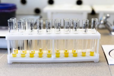 Laboratuvarda test tüplerinde sıvı ortamı test edin. Test tüplerindeki bakterilerin biyokimyasal tanımlaması için testler.