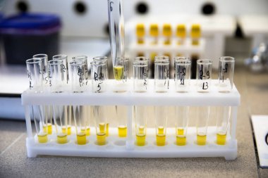 Laboratuvarda test tüplerinde sıvı ortamı test edin. Test tüplerindeki bakterilerin biyokimyasal tanımlaması için testler.