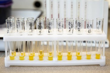 Laboratuvarda test tüplerinde sıvı ortamı test edin. Test tüplerindeki bakterilerin biyokimyasal tanımlaması için testler.