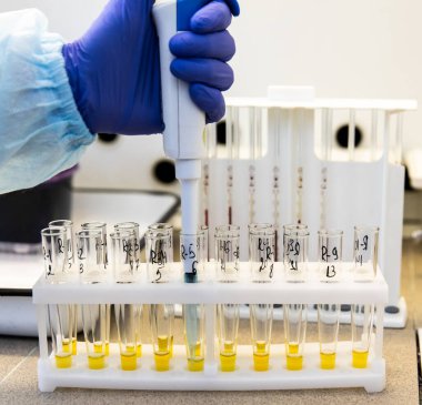 Laboratuvardaki test tüplerinde kan serumunu incele. Test tüplerindeki bakterilerin biyokimyasal tanımlaması için yapılan testler. Tıbbi laboratuvar ekipmanları.