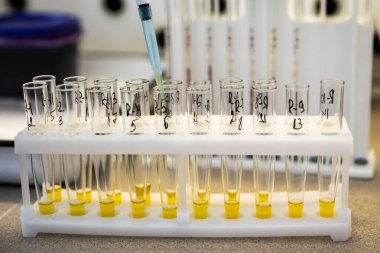 Laboratuvardaki test tüplerinde kan serumunu incele. Test tüplerindeki bakterilerin biyokimyasal tanımlaması için yapılan testler. Tıbbi laboratuvar ekipmanları.