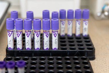 Gomel, Belarus-18 Ekim 2020: Vacusera kan toplama sistemleri. Laboratuvar testleri için venöz kan tüpleri..